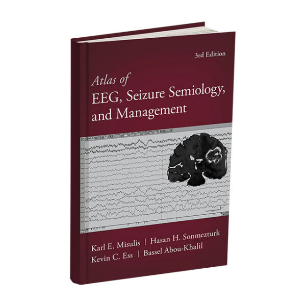 Atlas of EEG Seizure Semiology 2