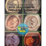 دانلود 3D Ultrasound in Prenatal Diagnosis:A Practical Approach 2nd Edition