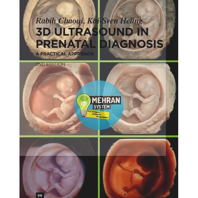 دانلود 3D Ultrasound in Prenatal Diagnosis:A Practical Approach 2nd Edition 1 دانلود 3D Ultrasound in Prenatal Diagnosis:A Practical Approach 2nd Edition