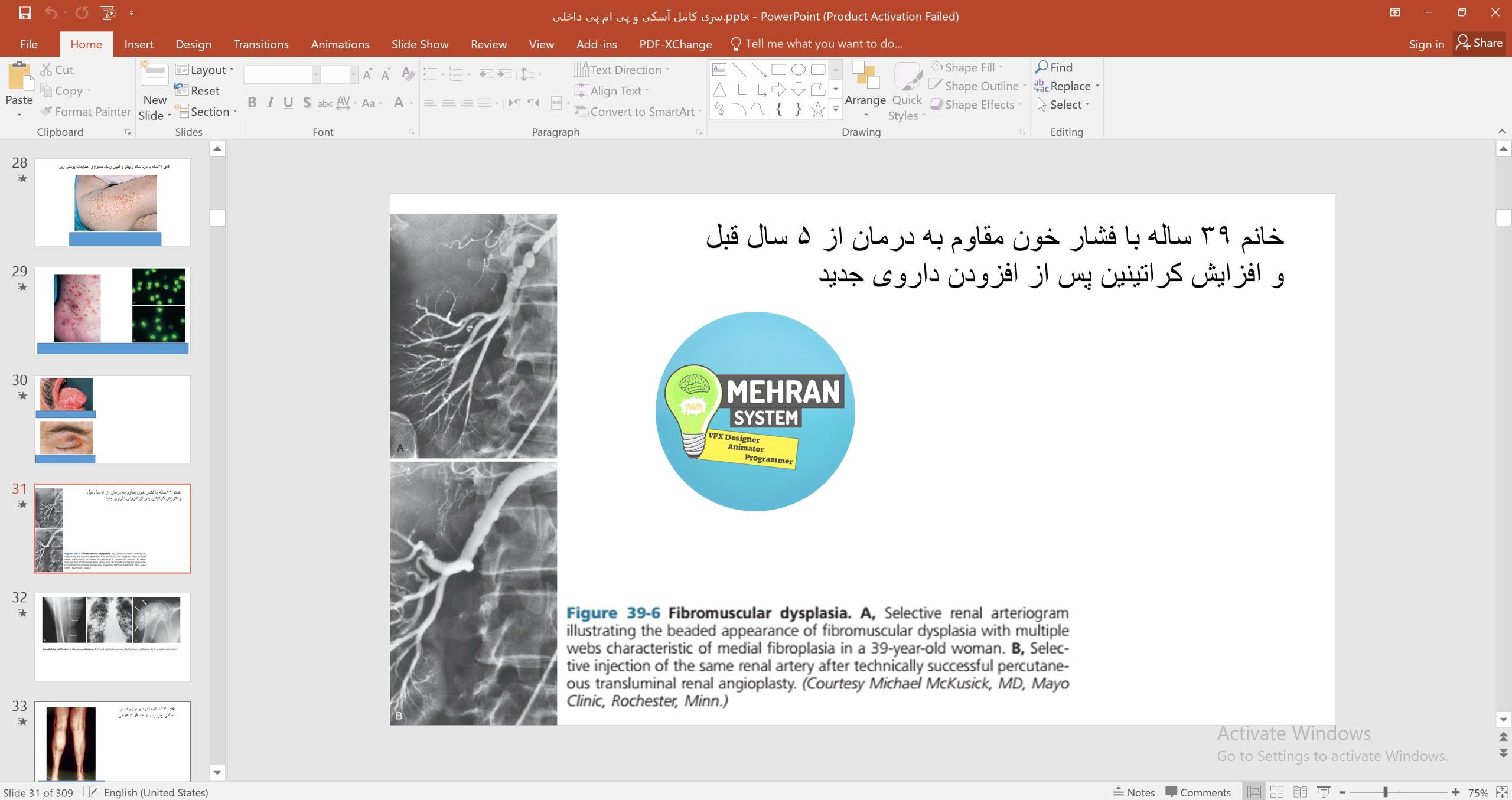 پاورپوینت جامع مرور مباحث آسکی و PMP رشته داخلی 2 نمونه تصویر پاورپوینت جامع مرور مباحث آسکی و PMP رشته داخلی